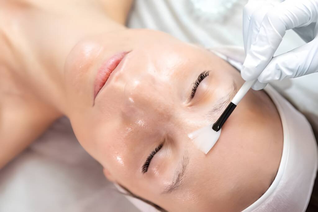 A professional esthetician applies a gentle chemical peel solution to a client’s forehead with a precision brush, highlighting the advanced skincare treatments offered at Spitale Laser Spa Salon. Chemical peel in Rochester.