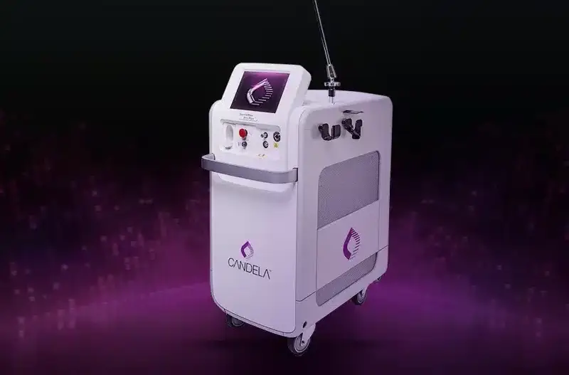 Candela machine. Laser hair removal in Rochester
